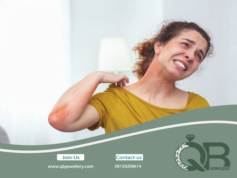 چه فلزهایی باعث ایجاد حساسیت می‌ شوند؟